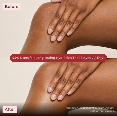 Brown Butters Raspberry Popsicle Body Butter before and after legs and hands with a 95% hydration banner