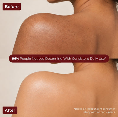 Brown Butters Strawberry Shortcake Body Wash before and after of a shoulder, with a 96% noticed detanning claim
