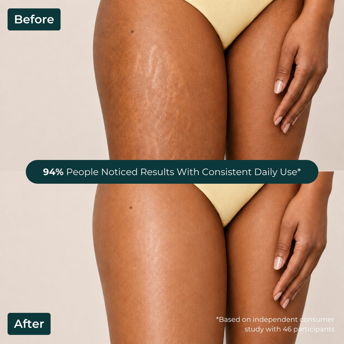 Brown Butters Coconut Truffle Body Lotion before and after of legs, with a 94% noticed results claim