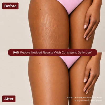 Brown Butters Strawberry Shortcake Body Lotion before and after of thighs in pink underwear on beige
