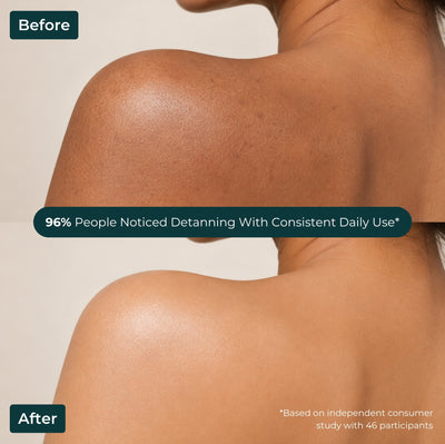 Brown Butters Coconut Truffle Body Wash before and after of a shoulder, with a 96% noticed detanning claim