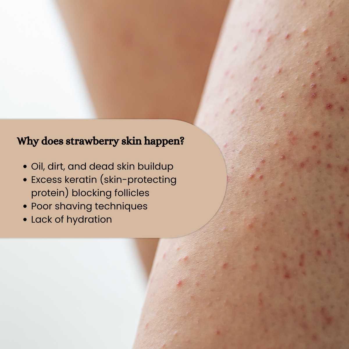 Brown Butters Cookie Dough Body Scrub card explaining strawberry skin, over a bumpy arm close-up