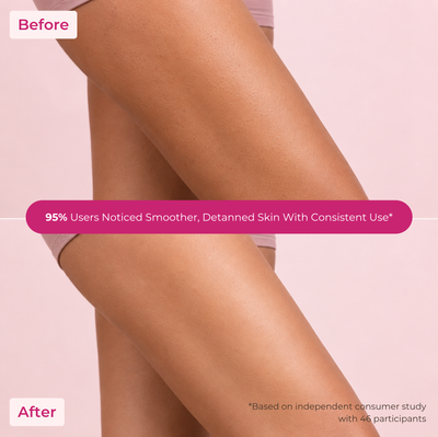 Brown Butters Tropical Vibes Duo before and after legs showing smoother detanned skin