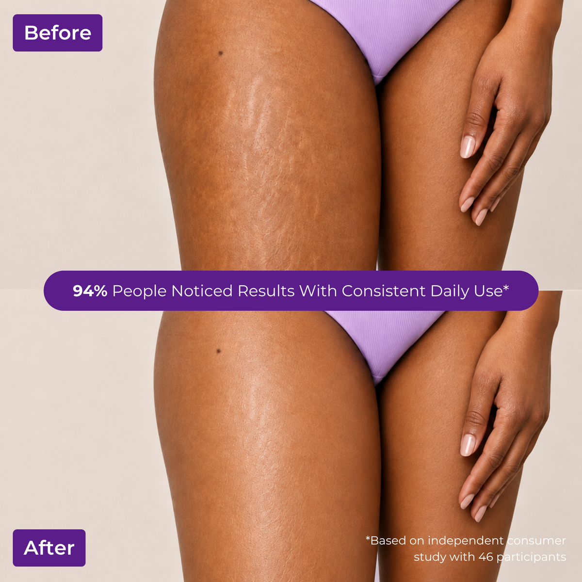 Brown Butters Birthday Cake Trio before and after thighs showing faded stretch marks