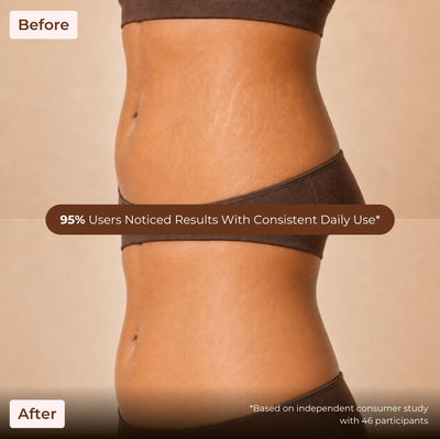 Brown Butters Chocolate Cookie Body Oil before and after of a midsection, with a 95% of users noticed results claim