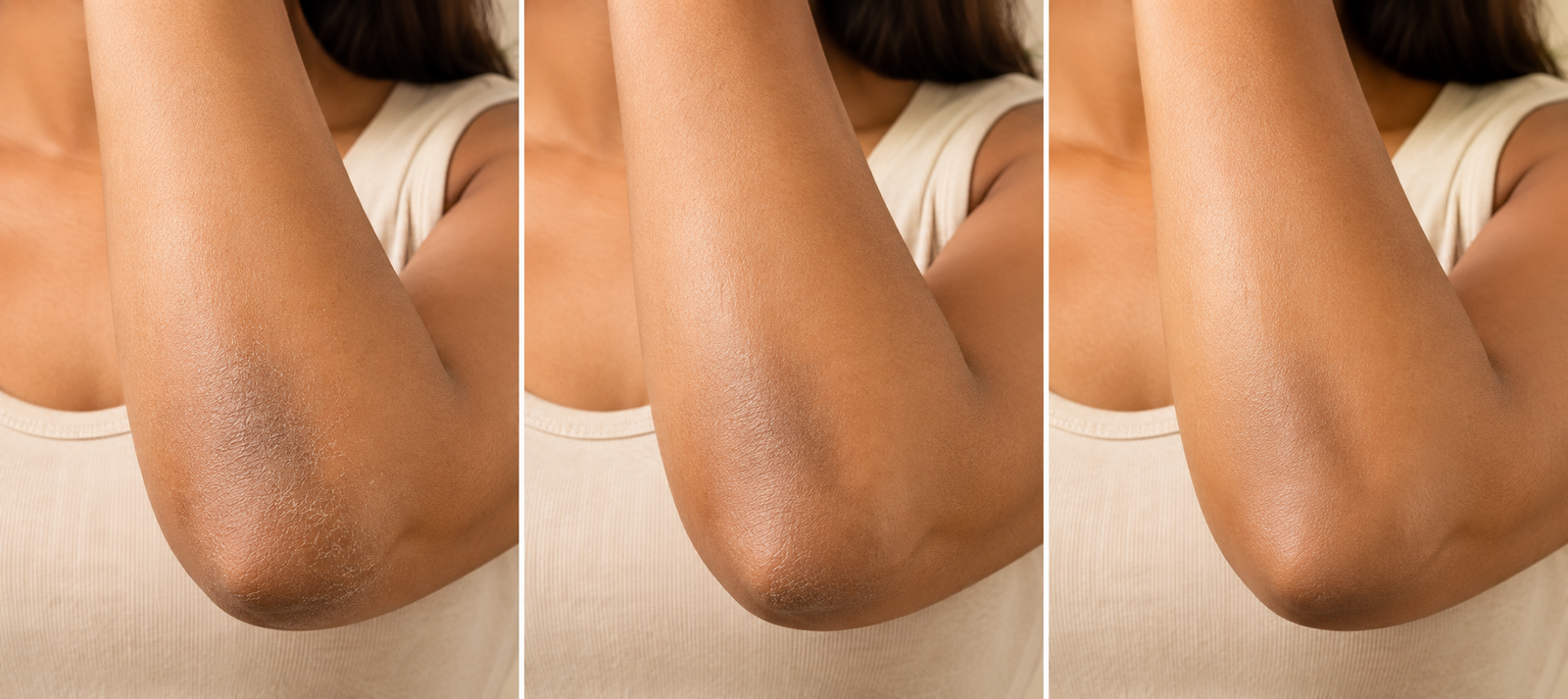 Skin over three stages of use