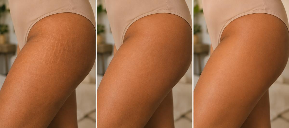 Brown Butters Coconut Truffle Body Lotion before and after results on real skin