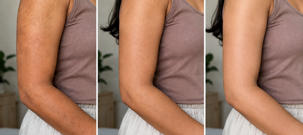 Brown Butters body wash results: the same skin before, during and after regular use